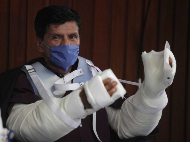 México realizó el primer trasplante de brazos en América Latina 